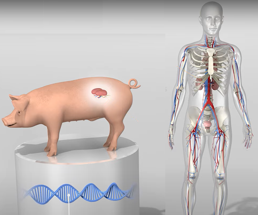 kidneys from genetically-engineered pigs could be transplanted into humans