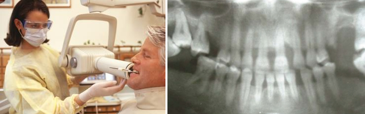 x-ray machines in dental offices produce low-level radioactive waste